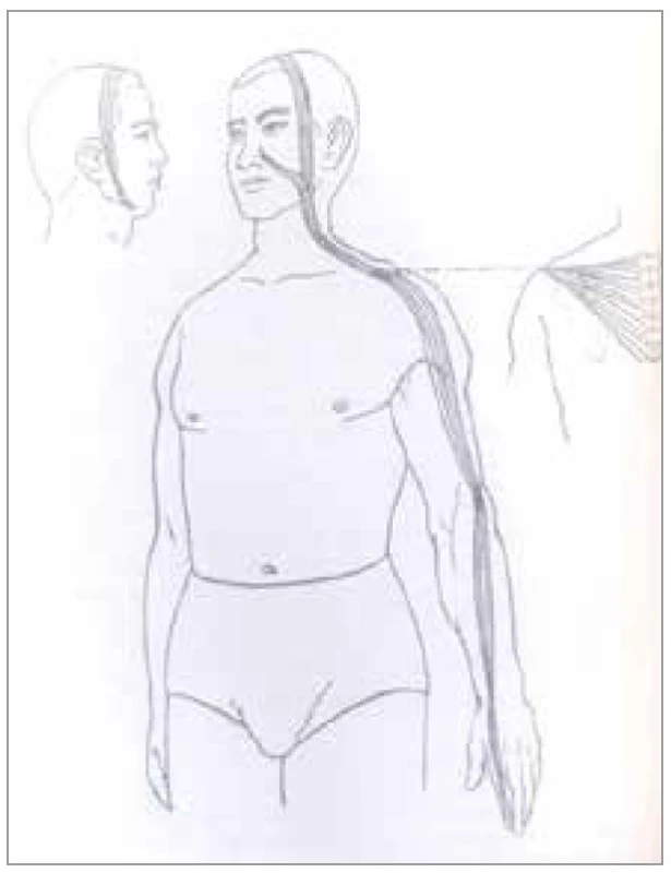 Šľachovo-svalová dráha hrubého čreva<br>
Fig. 3. Tendon-muscle path of the colon