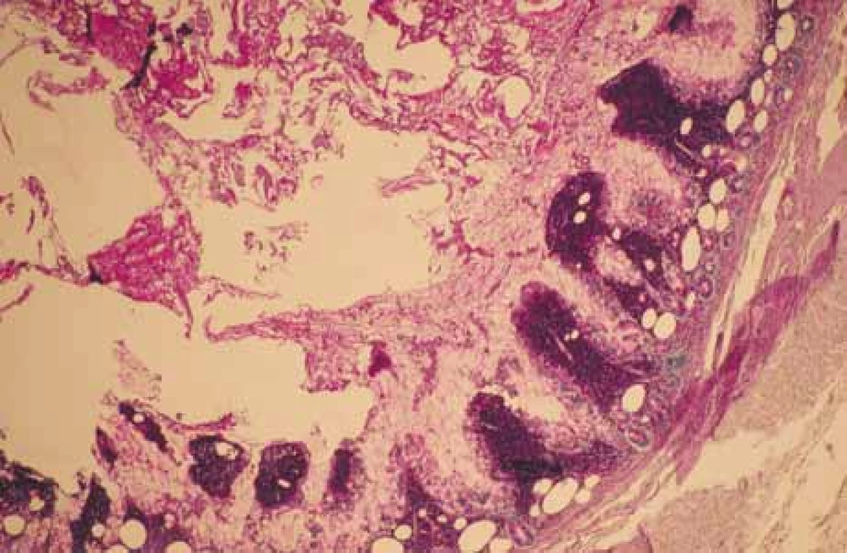 PAS + makrofágy.<br>
PAS + macrophages.