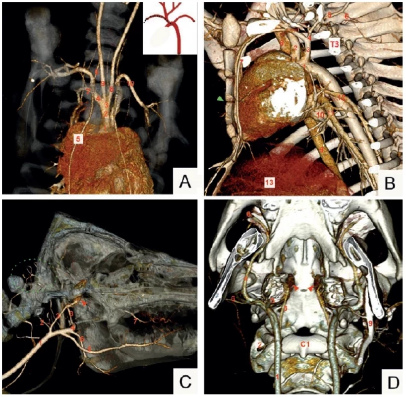 CT angiografie prasete domácího, plemeno Přeštické černostrakaté, volume rendering technique (VRT); hrudník
zpředu (A), v boční projekci, pohled zleva (B); hlava, pohled zprava (C), basis cranii externa (D) <br> 
Fig. 1. CT angiography, domestic pig, Prestice Black Pied breed, VRT; thorax, anterior view (A); left lateral view (B); head,
right lateral view (C), external cranial base (D)