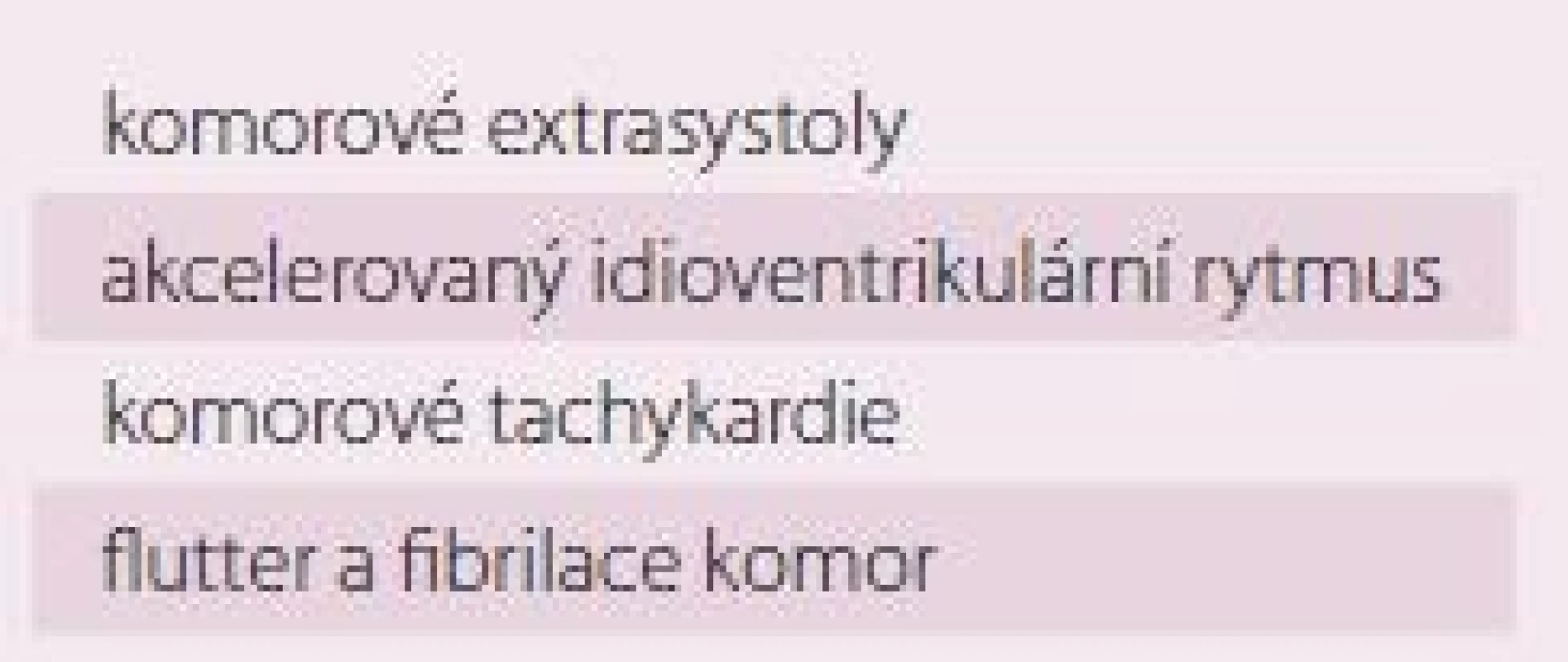 Dělení komorových tachykardií dle EKG kritérií [2].