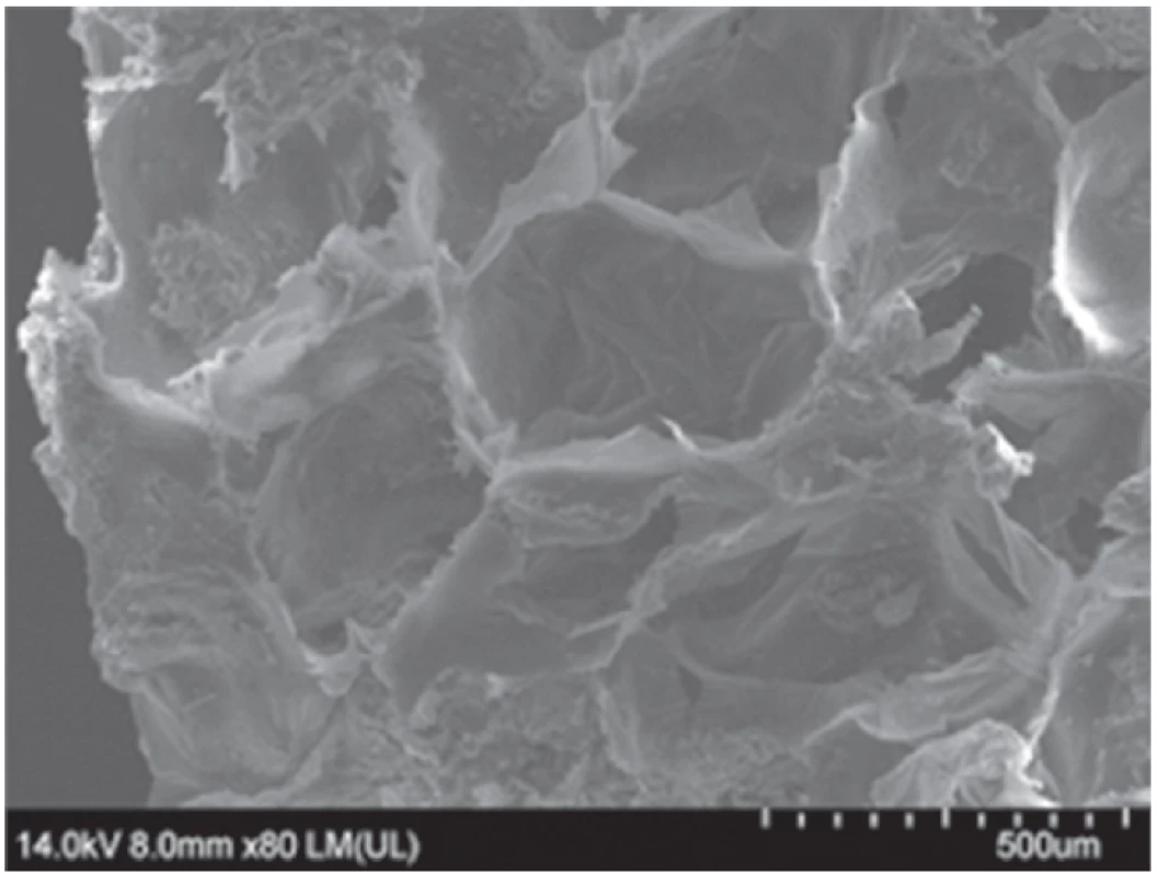 The thin Eudragit® NE layer inside the HPMC K4M matrix structure (image from
scanning electron microscopy)<sup>52)</sup>