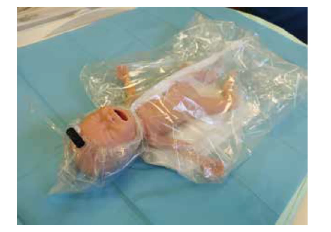Krytí nedonošených polyetylenovým obalem.<br>
Fig. 2. Cover preterm infants with polyethylene wrap.