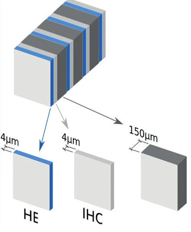 Protokol pro ultrastaging při vyšetření sentinelových uzlin