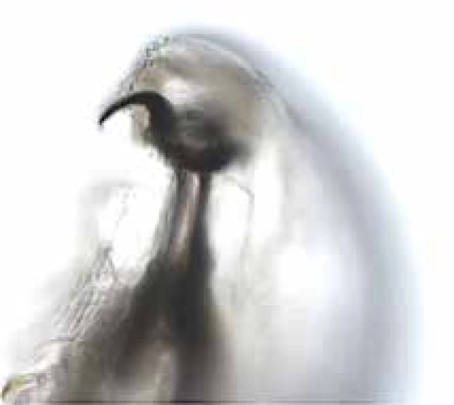 Detail of right rostral hook of Oestrus ovis larva in view
from ventral side (enlarged 200x)