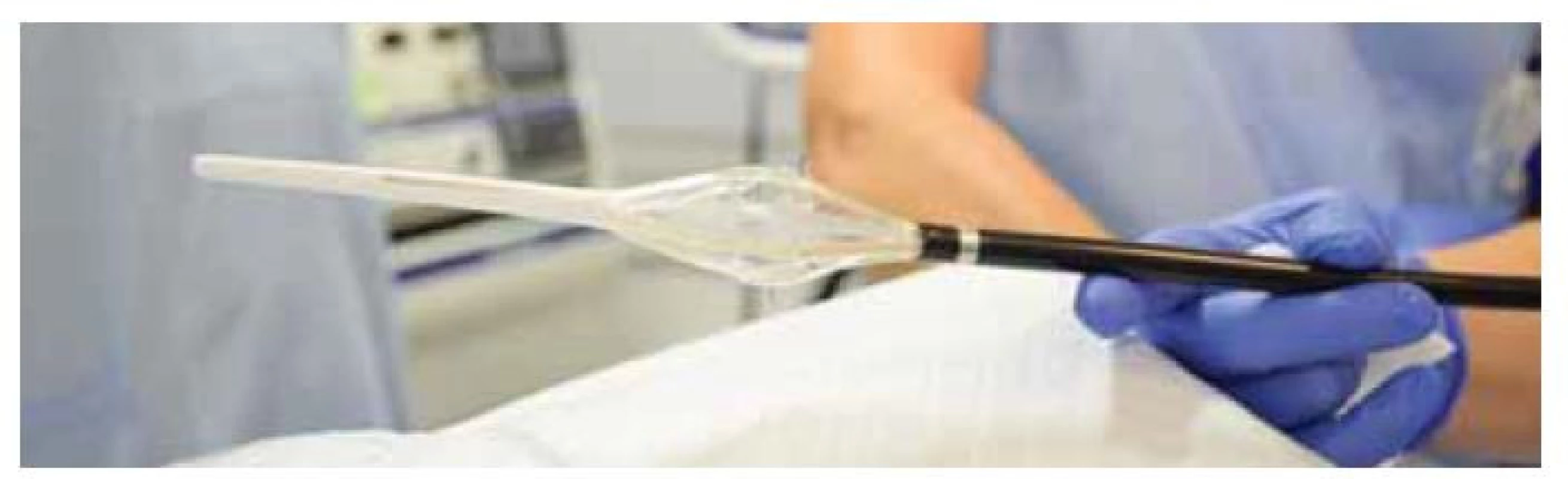 Stretta katétr.<br>
Zdroj: Archiv Oddělení gastrointestinální endoskopie, ÚVN – Vojenská fakultní nemocnice,
Praha.<br>
Fig. 2. Stretta catheter.<br>
Source: Department of Gastrointestinal Endoscopy archive, Military University
Hospital, Prague, Czech Republic.