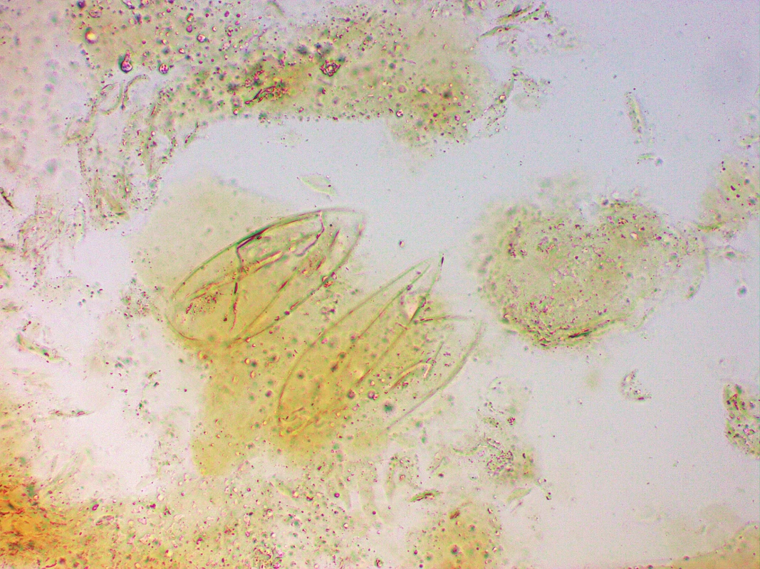 Prázdná vajíčka Sarcoptes scabiei z odebraných šupin, světelný mikroskop, 10% KOH, zvětšeno 200x.<br>
Fig. 4. Sarcoptes scabiei empty ova, sample from skin scales, light microscopy, 10% KOH mount, magnification 200x.