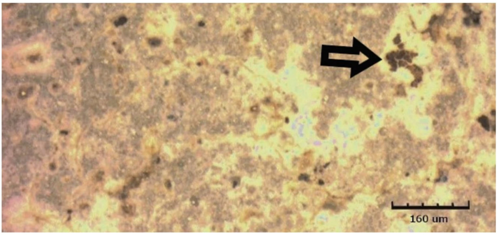 Omnifill C vystavený kyselému pH po dobu 14 dnů, zobrazeno CLSM<br>
Fig. 8 Omnifill C exposed to acidic pH for 14 days, shown by CLSM