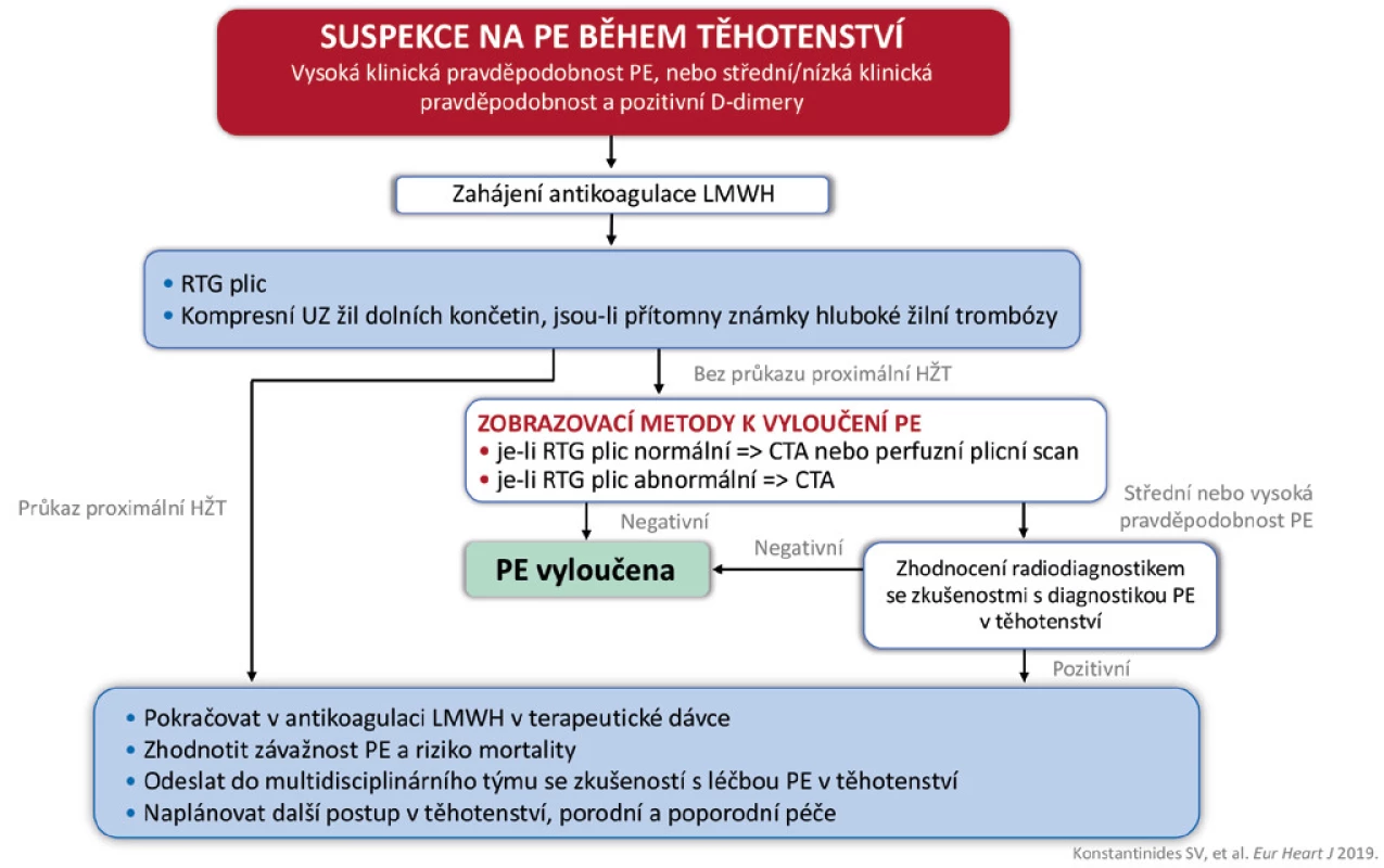 Diagnostika plicní embolie v těhotenství
