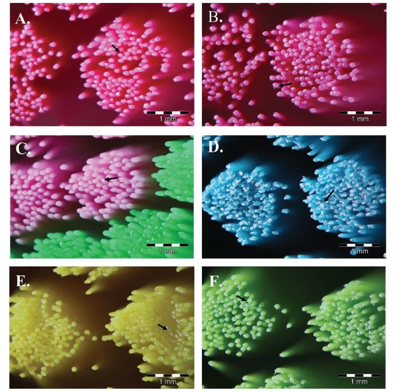 Stereomikroskopický
snímek.<br>
A. Curaprox 5460;<br>
B. Dr.Max PRO32 Extra soft
5400;<br>
C. Tepe Compact x – soft;<br>
D. Spokar X 5500 Ultrasoft;<br>
E. SOFTdent ECO Ultrasoft;<br>
F. Elmex Ultrasoft
– pod zvětšením 40×.<br>
Fig. 1 Stereomicroscopy
image.<br>
A. Curaprox 5460;<br>
B. Dr.Max PRO32 Extra soft
5400;<br>
C. Tepe Compact x – soft;<br>
D. Spokar X 5500 Ultrasoft;<br>
E. SOFTdent ECO Ultrasoft;<br>
F. Elmex Ultrasoft
– under 40× magnification.