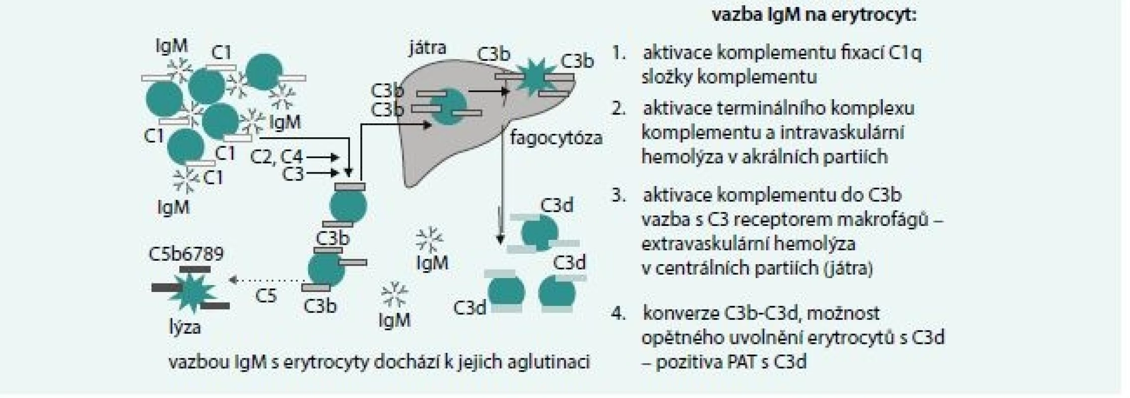 Mechanizmy IgM zprostředkované hemolýzy