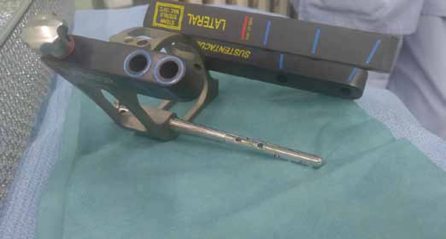 Assembled targeting device with the C-Nail