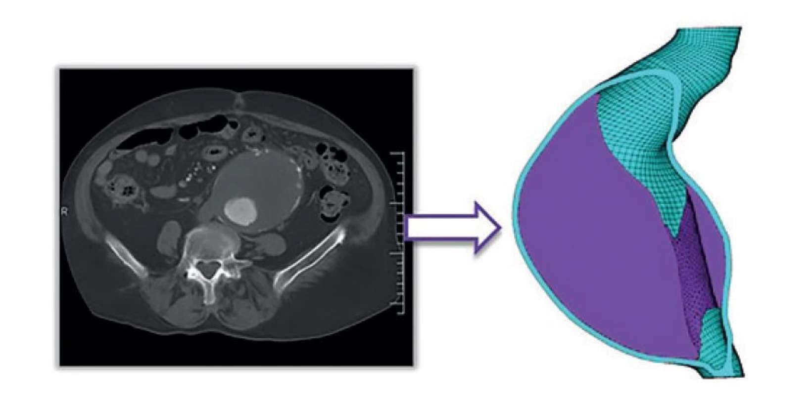 3D modelace AAA<br>
Fig. 3: 3D modeling of AAA