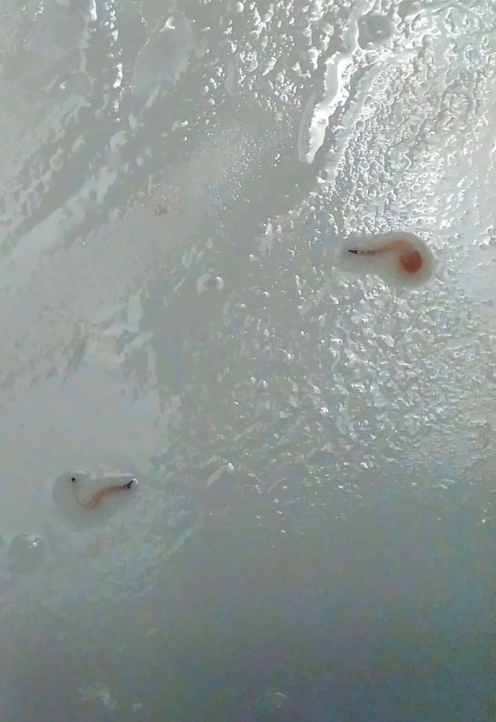 Larvy C. albipunctata ve směsi slin a zubní pasty (archiv
pacienta)<br>
Figure 4. C. albipunctata larvae in a mixture of saliva and
toothpaste (patient’s archive)