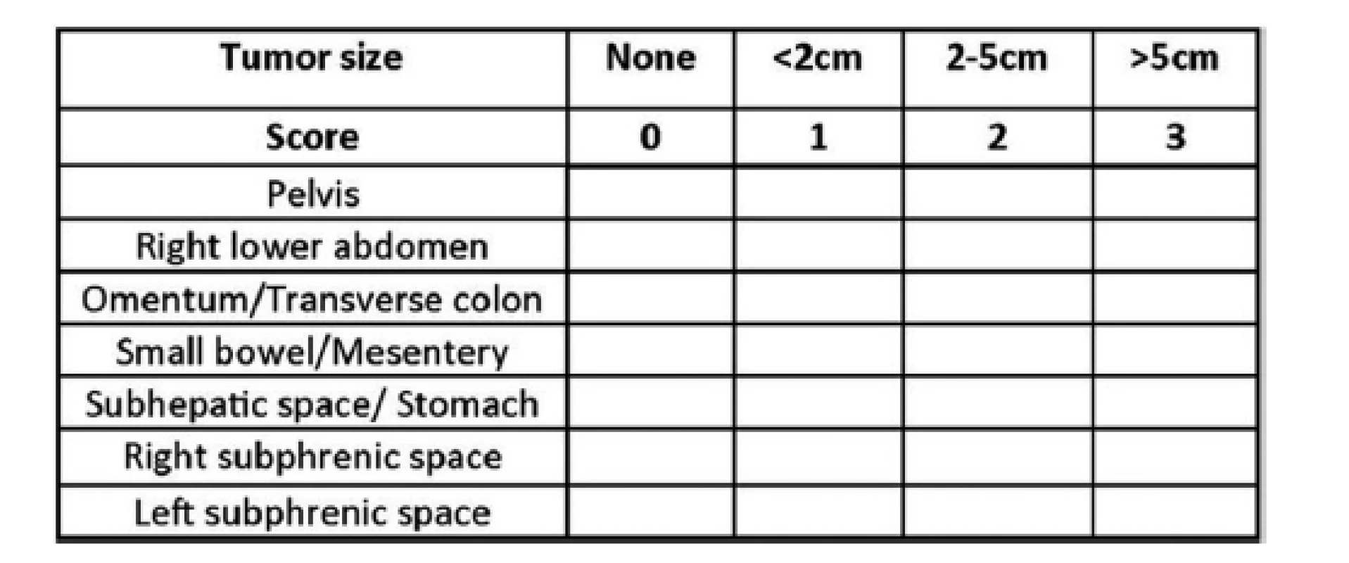 Simplified peritoneal cancer index (SPCI) − součet
velikostí nádorových lézí pro všechny oblasti je 21<br>
Fig. 1: Simplified peritoneal cancer index (SPCI) − the sum
of sizes of the tumour lesions for all areas is 21