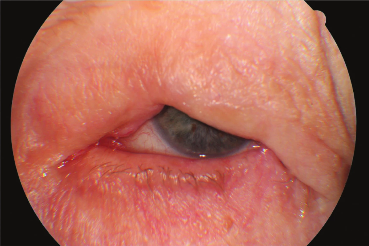 Clinical findings Patient 1 in year 2015