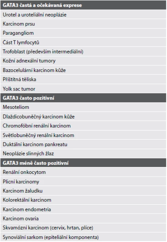 Exprese GATA3 různými tkáněmi a nádory – převzato Cox et kol. (10).