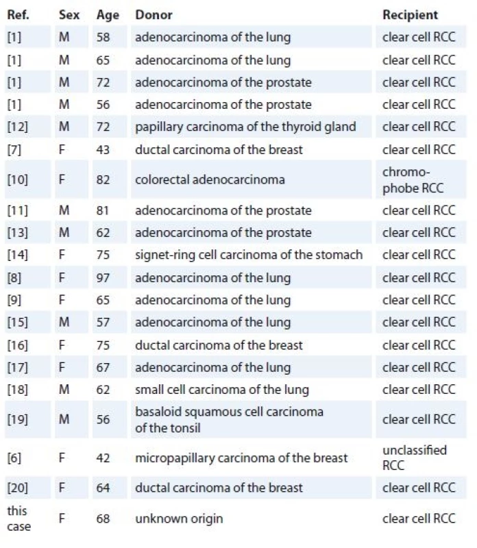 Summary of clinicopathologic fi ndings of the patients extracted from the
published case reports.