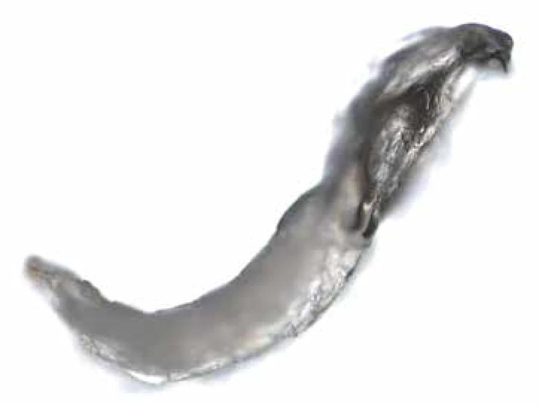 Oestrus ovis larva from side view (enlarged 100x) – well
visible eyes and one hook
