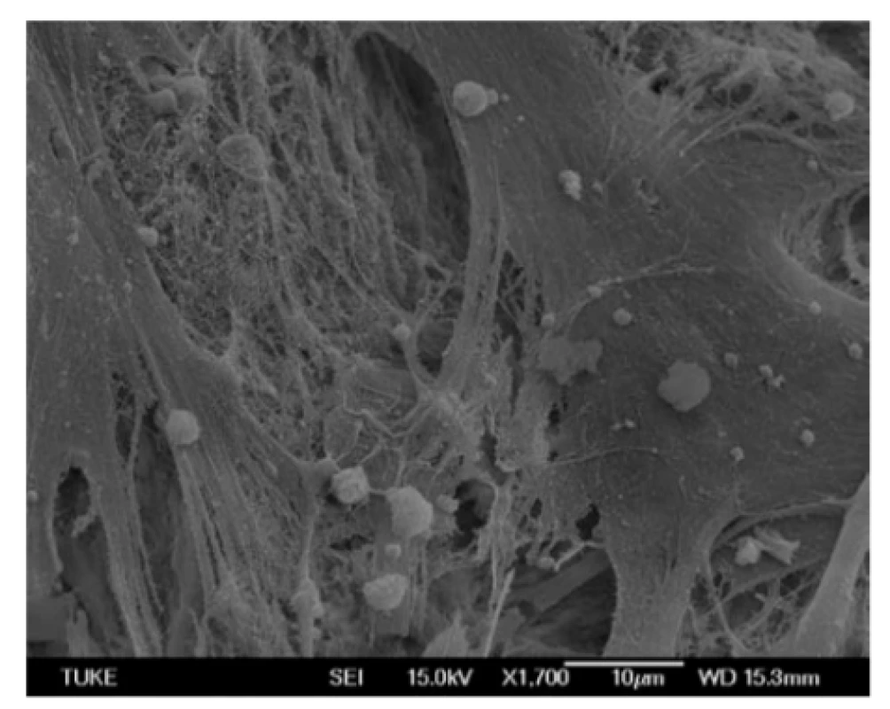 The surfaces of bovine bone tissue with attached
hMSCs