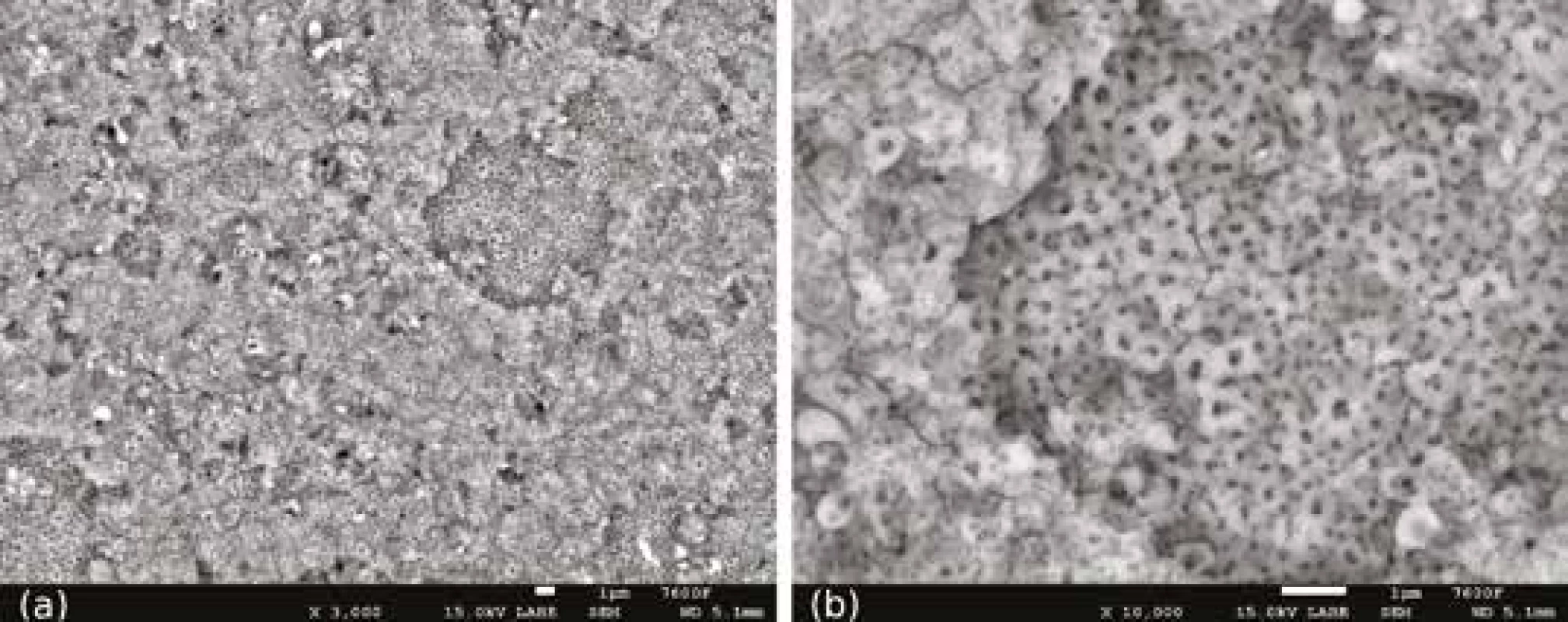 Anodizovaný povrch vzorků
z Ti6Al4V ELI, přehled (a)
a detail (b)<br>
Fig. 1
Surface of anodized
Ti6Al4V ELI samples, overview (a)
and detail (b)