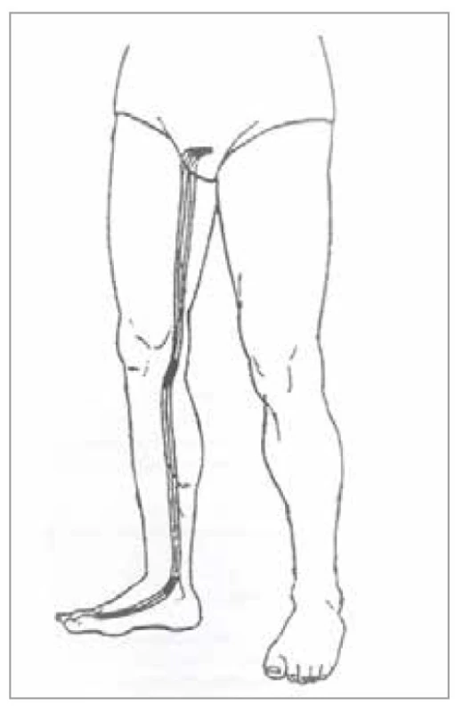 Šľachovo-svalová dráha
pečene<br>
Fig. 23. Tendon-muscle pathway of the
liver