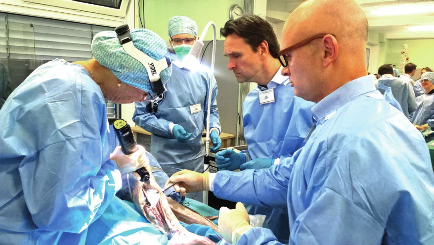 Preparační kurz – odběr fibulárního laloku vč. kosti
(účastnice kurzu a instruktoři: Prof. Dr. Dr. F. Hölzle, Prof. Dr. B.
Krapohl, Prof. Dr. med. S. Eisenhardt). Humánní preparáty celé.