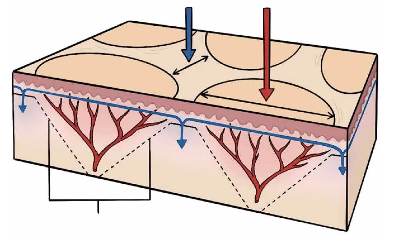 Schéma uspořádání kožní vaskulatury (adaptováno dle [3]). Černá svorka – arteriální kužel, červená šipka – zóna arteriální predominance, modrá šipka – zóna venózní predominance.
