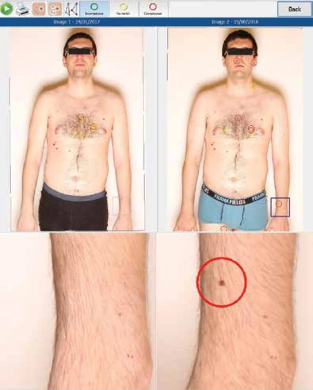 Fotografie z předchozích kontrol
