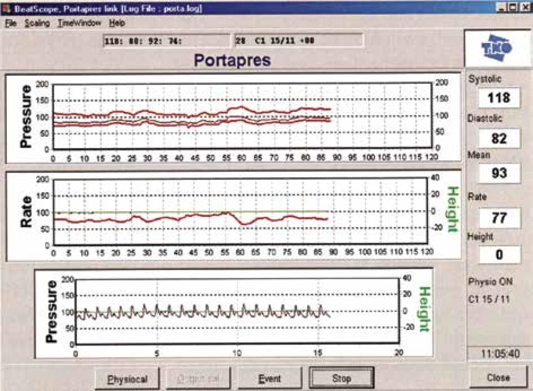 Monitorovanie záznamu (FMS). Použitý obrázok je z manuálu Portapresu – z monitorovania
dospelého človeka.<br>
Fig. 2. Portapres, the monitoring and control screen. The image used is from the Portapres
User´s Guide – from monitoring of an adult.