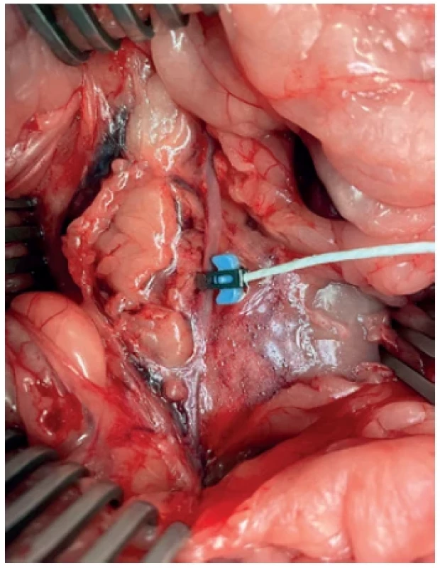 Flow rate measurement on abdominal aorta of the
rabbit