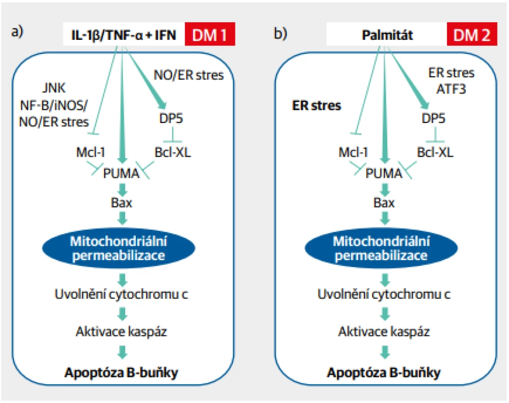 Jednotící model patogeneze diabetu 1. a 2. typu na úrovni B-buňky. Aktivace B-buňky cytokiny a dalšími
faktory zánětlivé reakce (diabetes 1. typu) nebo mastnými kyselinami (diabetes 2. typu) vede k nitrobuněčnému oxidačnímu stresu přes aktivaci endoplazmatického retikula, k poškození mitochondrií, aktivaci kaspáz
a následné apoptóze B-buňky