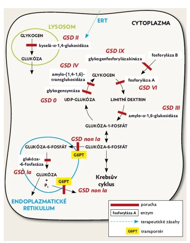 Schéma metabolismu glykogenu v jaterní buňce. Štěpení
glykogenu probíhá v cytoplazmě, lineární části řetězce jsou štěpeny
fosforylázou A. Větvící místa jsou odbourávána odvětvujícím enzymem
(debranching enzyme; amylo-alfa1,6-glukosidáza). Vytvořený
glukóza-1-P se mění fosfoglukomutázou na glukóza-6-P, který je
důležitý v procesu glykolýzy i glukoneogeneze. V jaterních buňkách
se glukóza-6-P transportuje pomocí transportéru glukóza-6-P
(G6PT) do endoplazmatického retikula, kde se činností glukóza-
-6-fosfatázy mění na volnou glukózu uvolňovanou do krevního
oběhu. Lysosomální kyselá alfa-1,4-glukosidáza se hlavní metabolické
dráhy neúčastní, ale část glykogenu se při procesu autofagie
dostává do lysosomu.(6)
