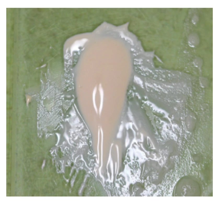Čerstvo namiešaný
polyepoxidový sealer
AD Seal™<br>
Fig. 3
Freshly mixed
poly-epoxide sealer
AD Seal™