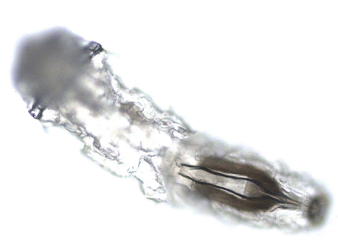 Oestrus ovis larva from ventral view (enlarged 100x) with
detail of internal organs
