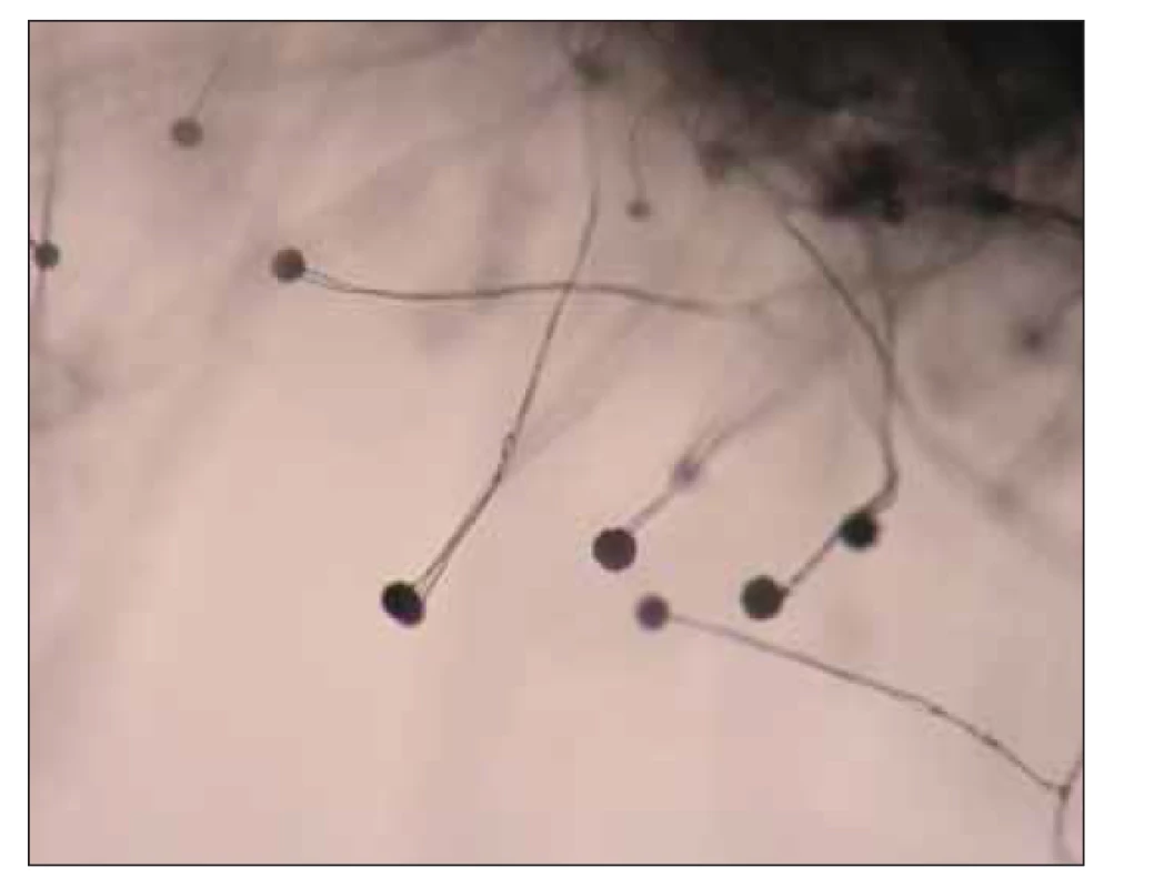 Mikrokultura Mucor sp.<br>
(zdroj: Ústav mikrobiologie LF UP a FN Olomouc).
