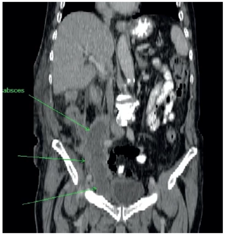 Vertikálny rez <br> 
Fig. 5. Vertical section