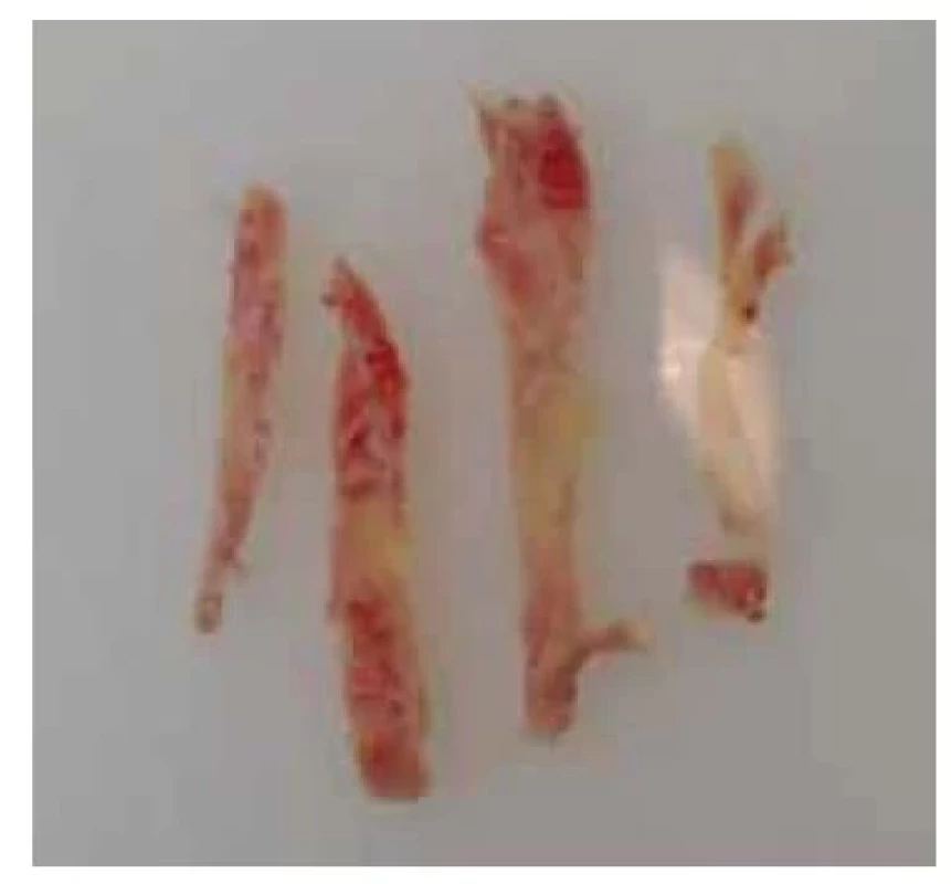 Proužky kortikální tkáně
připravené pro kryokonzervaci.<br>
Fig. 7. Strips of cortical tissue prepared
for cryopreservation.