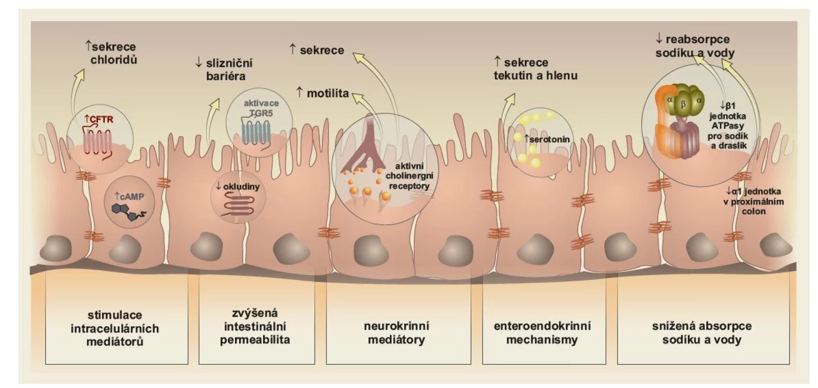 Patofyziologie průjmů u malabsorpce žlučových kyselin.<br>
CFTR – cystic fibrosis transmembrane conductance regulator (regulátor transmembránové vodivosti u cystické fibrózy; tento
regulátor však má širší patofyziologické uplatnění, netýká se pouze cystické fibrózy); cAMP – cyklický adenosin monofosfát;
TGR5 – Takeda G protein-coupled receptor 5 (receptor proteinu, jehož primární funkcí je transdukce extracelulárních stimulů na
intracelulární signalizaci); ATPase – enzymy hydrolyzující adenosin trifosfát. Zpracováno podle Marasco et al (2022 [3]. <br>
Kresba: Hana Kotlandová.<br>
Fig. 3. Pathophysiology of diarrhea in bile acid malabsorption.<br>
CFTR – cystic fibrosis transmembrane conductance regulator; cAMP – cyclic adenosine monophosphate; TGR5 – Takeda G protein-
coupled receptor 5; ATPase – adenosine triphosphate-hydrolyzing enzymes. Adopted from Marasco et al (2022 [3].<br>
Drawing: Hana Kotlandová.