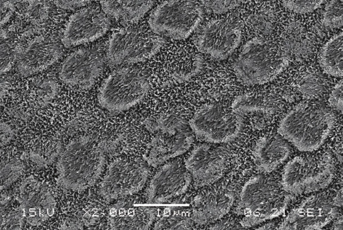 Enamel surface with exposed prisms after phosphoric acid etching.
Scanning electron microscope, magnification 2000×.
