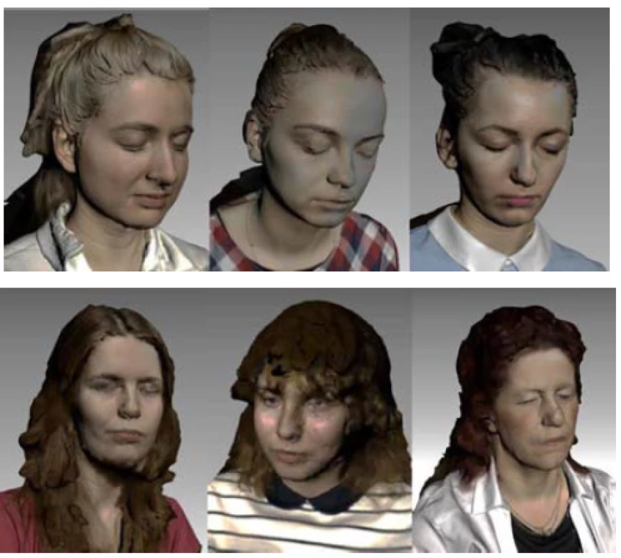 Overview of the scanned hair types.