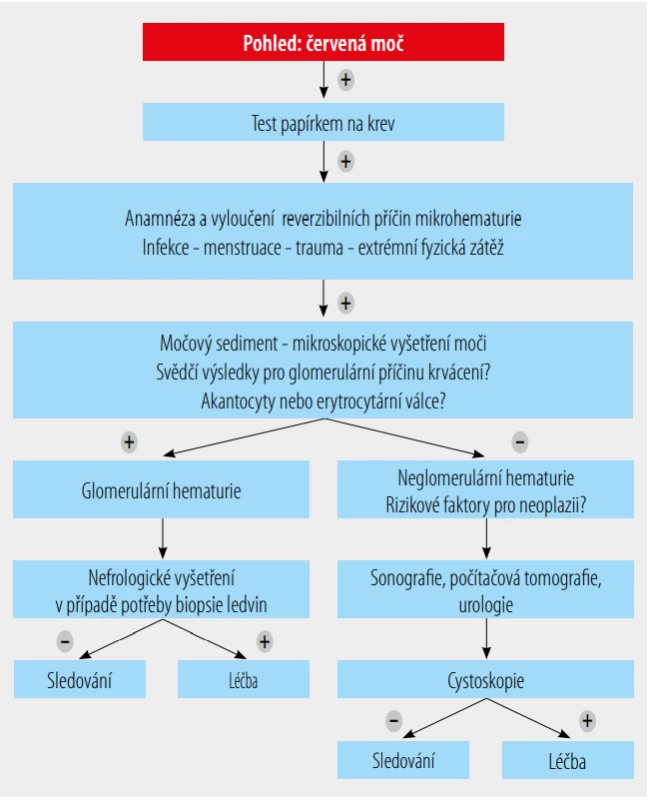  Algoritmus diagnostického postupu při hematurii.