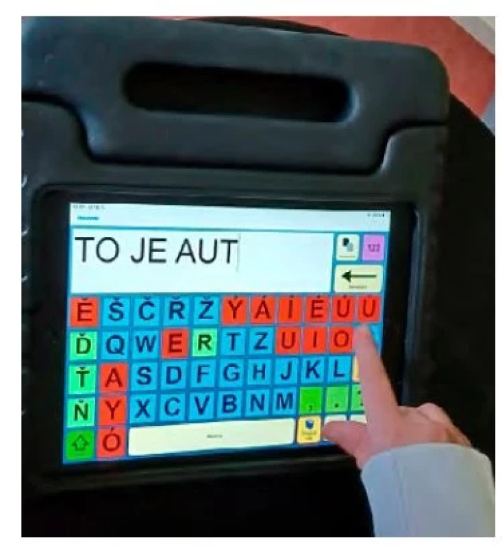 Psaní B. na klávesnici v iPadu.
Klávesnice byla vytvořena v programu
Grid 2