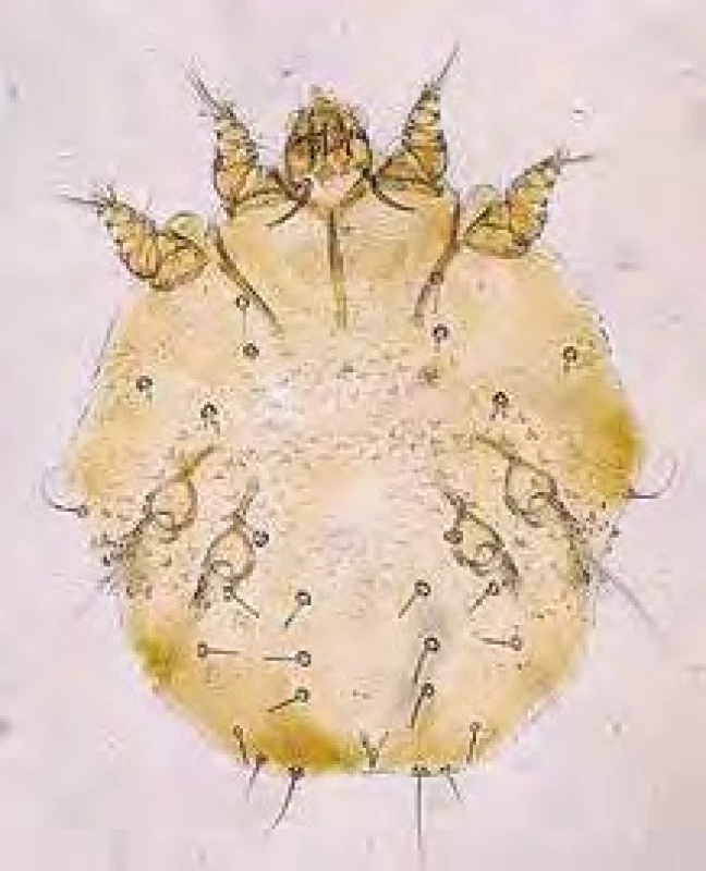 Sarcoptes scabiei (zákožka svrabová), roztoč.
[Foto: Alan R Walker; https://commons.wikimedia.org/
wiki/File:Sarcoptes-scabiei.JPG]