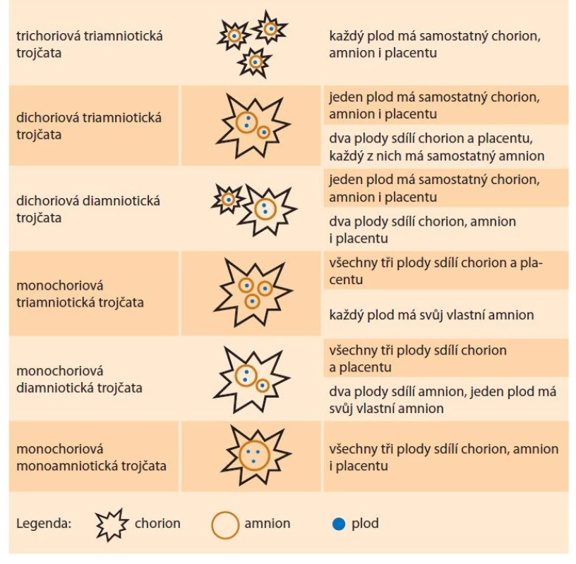 Varianty trojčetného těhotenství dle chorionicity a amnionicity (autor:
Osičková V).<br>
Tab. 1. Variants of triple pregnancy according to chorionicity and amnionicity
(author: Osičková V).