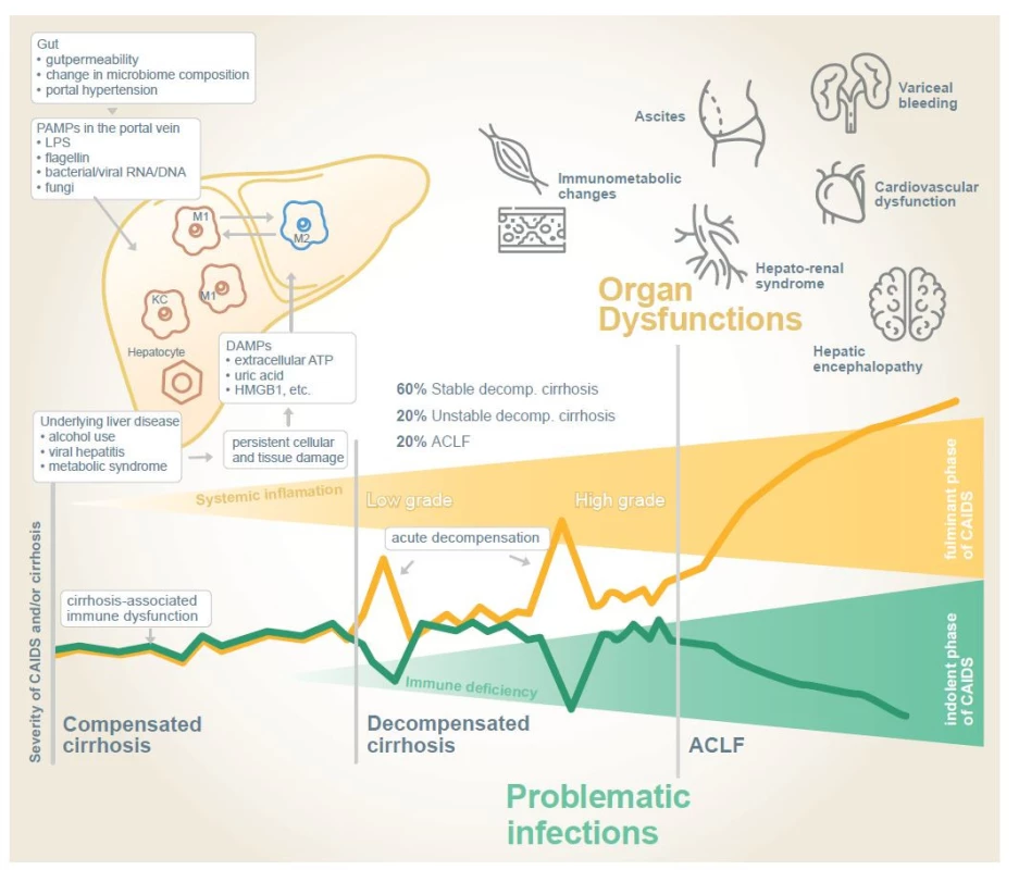 Fig. 1. Dynamics of cirrhosis-associated immune dysfunction [4,26].<br>
Obr. 1. Dynamika imunitnej dysfunkcie spojenej s cirhózou [4,26].