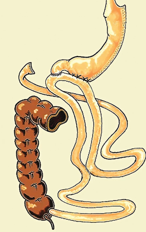 SADIS<br>
Fig. 2: SADIS