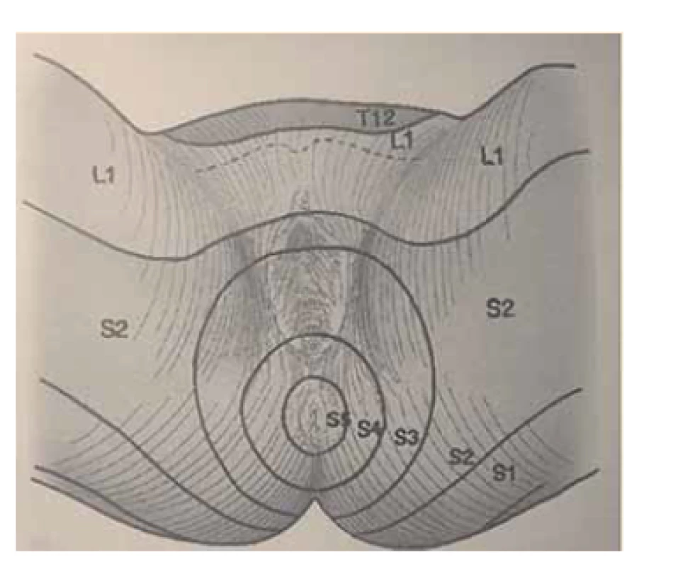 Dermatomy perineální oblasti.<br>
Fig. 3. Dermatomes of the perineal
region.