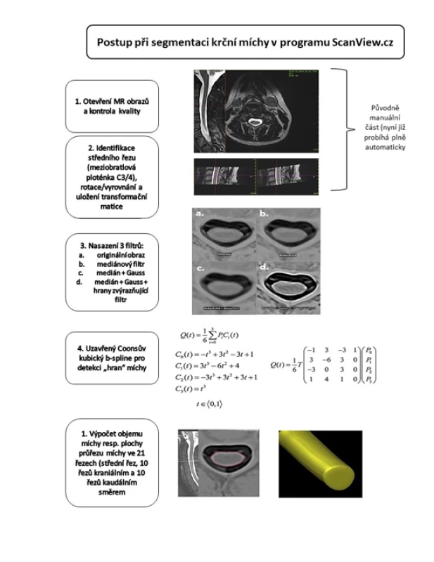 Schéma postupu při segmentaci krční míchy.<br>
Fig. 1. Schematic representation of the proposed pipeline for spinal cord segmentation.

