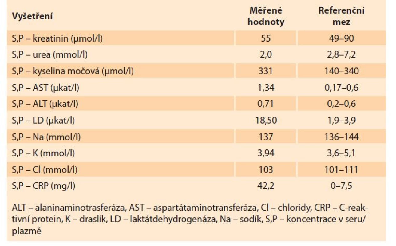 Laboratorní nálezy – biochemie.<br>
Tab. 3. Laboratory findings – biochemistry.