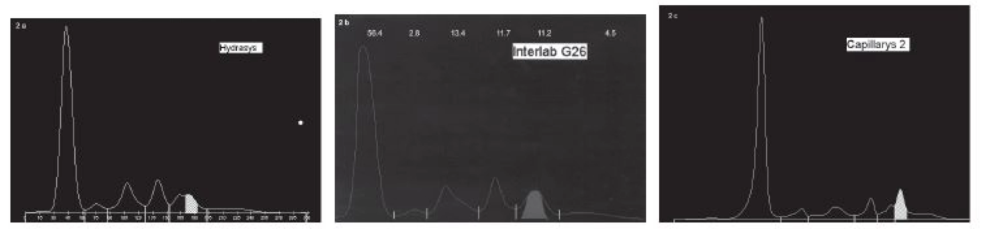 Assessment of mutual differences between analyzers on the type of paraprotein using parallel coordinates plot and
boxplots.